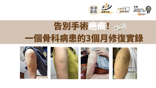 告別手術疤痕！一個骨科病患的3個月修復實錄