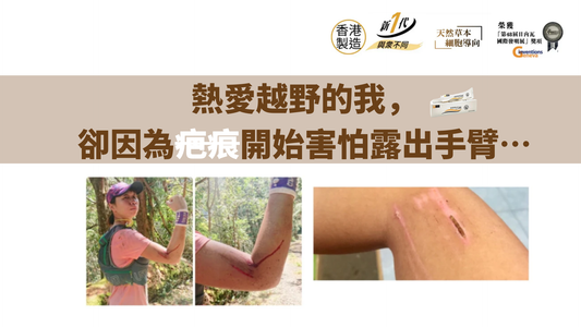 熱愛越野的我，卻因為疤痕開始害怕露出手臂…